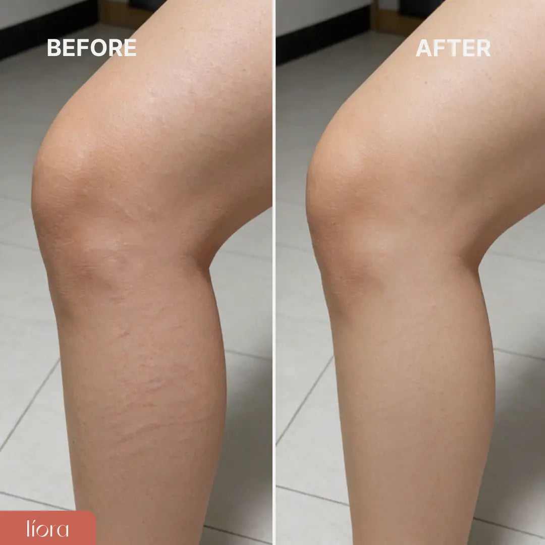 Líora® ThermoFlow Electric Thermal Body Massager